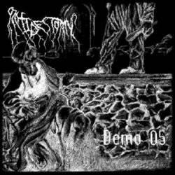 Orchidectomy : Demo 05 Orchidectomy : Demo 05